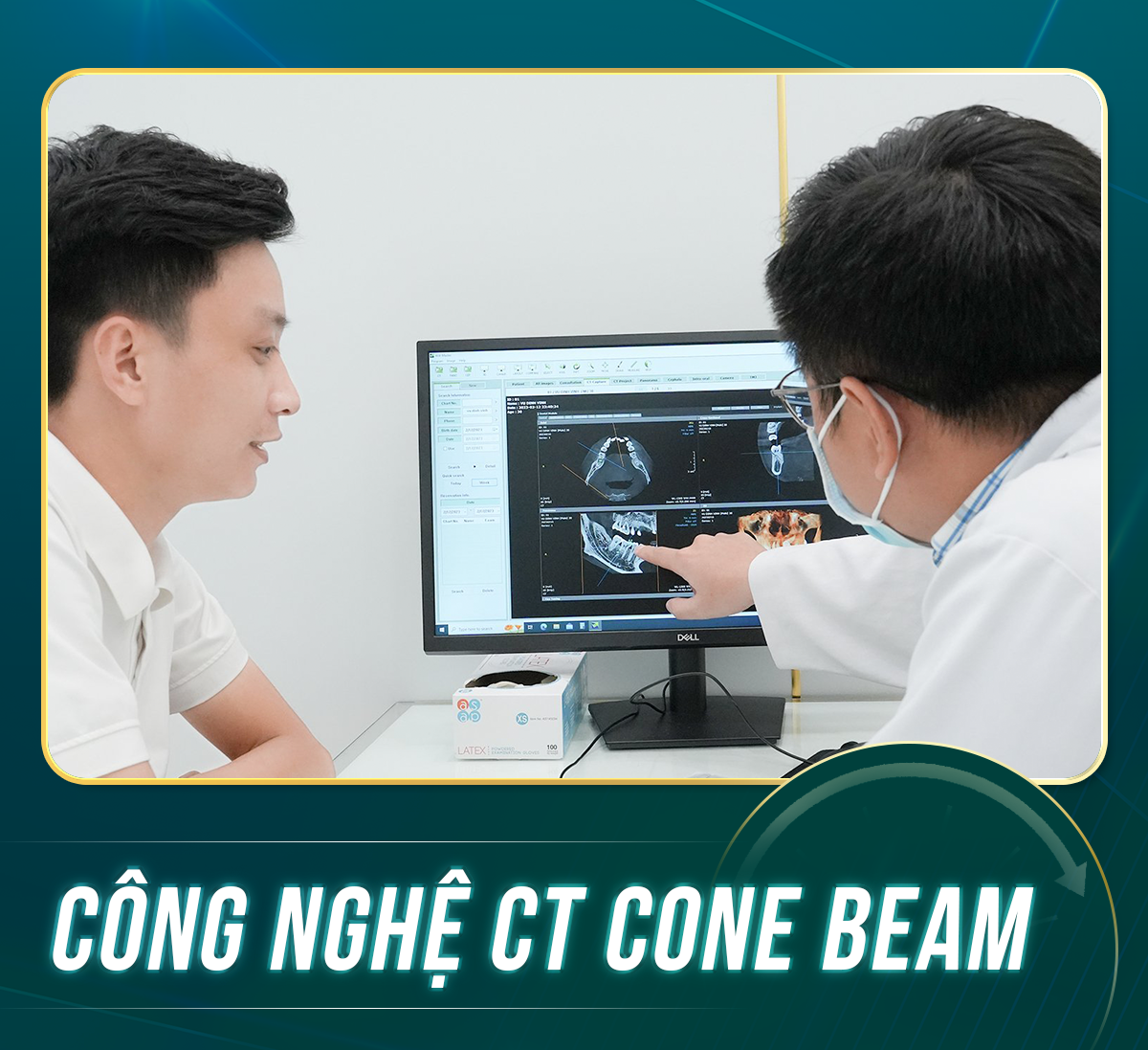 CONG NGHE CT CONE BEAM 4