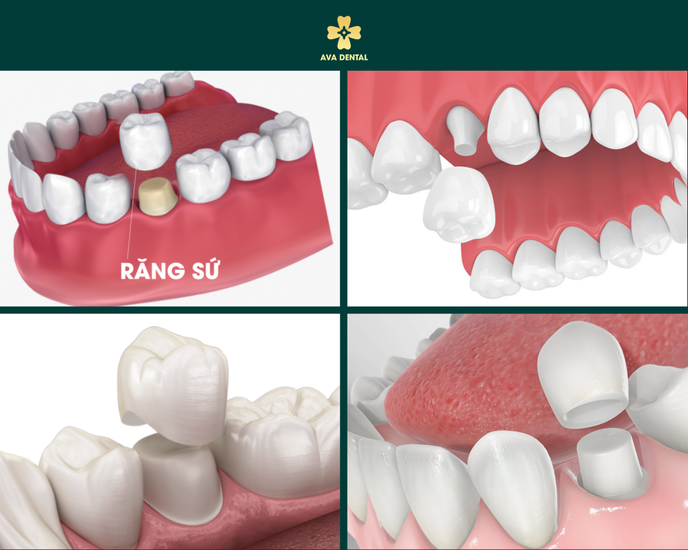 khung web 1