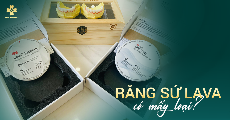 răng sứ lava có mấy loại 