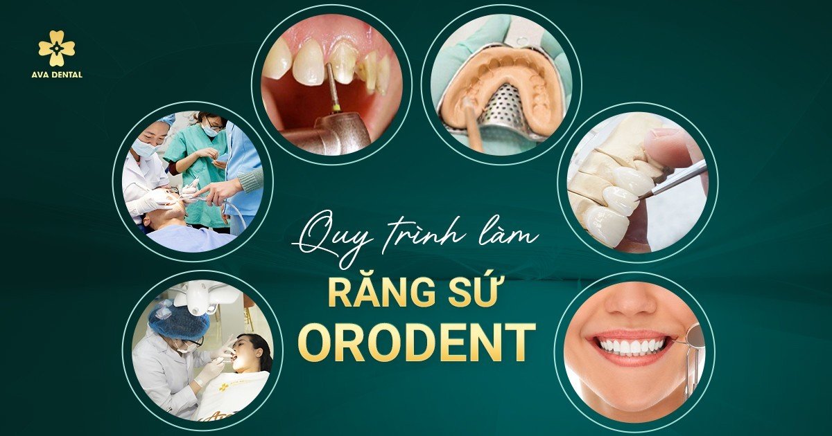 quy trình bọc sứ orodent