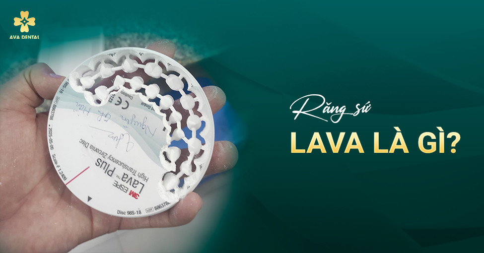 răng sứ lava