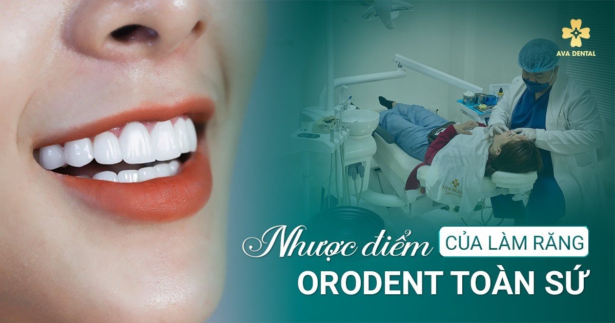nhược điểm răng sứ orodent