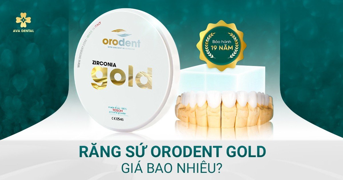 răng sứ ordent gold giá bao nhiêu