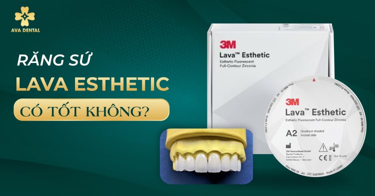 Răng sứ Lava Esthetic có tốt không
