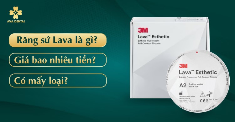 Răng sứ lava là gì