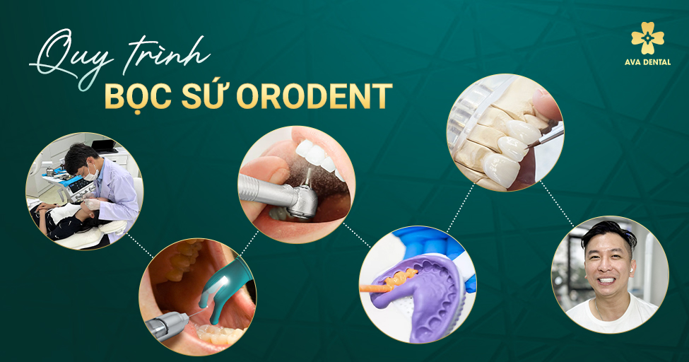 răng sứ orodent