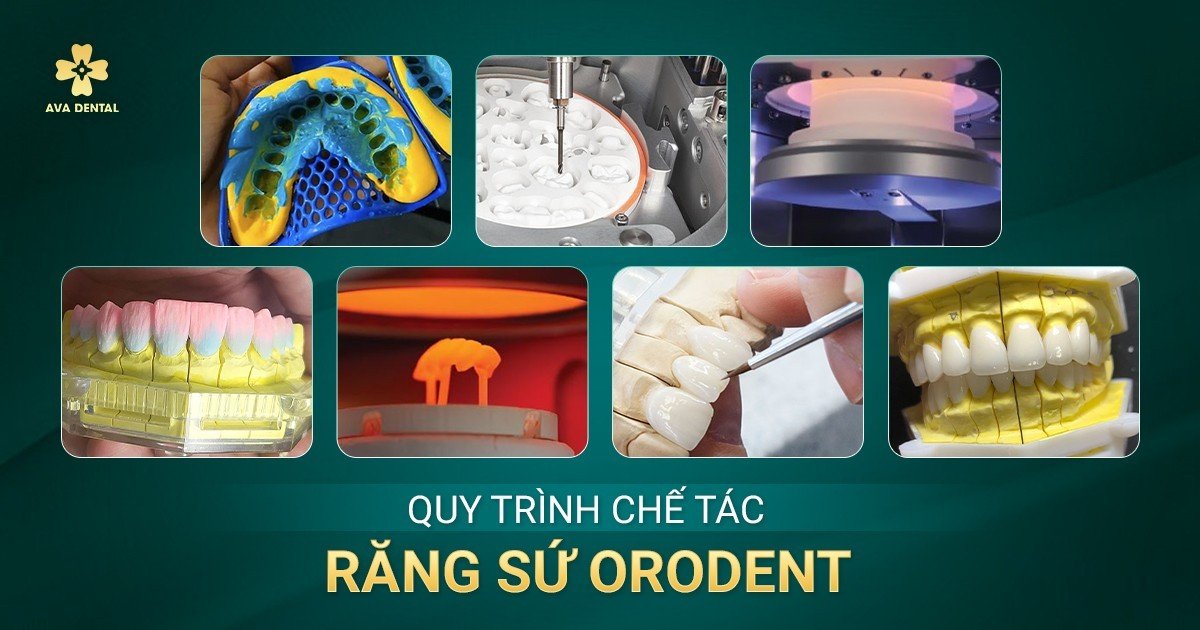 quy trình chế tắc răng sứ orodent