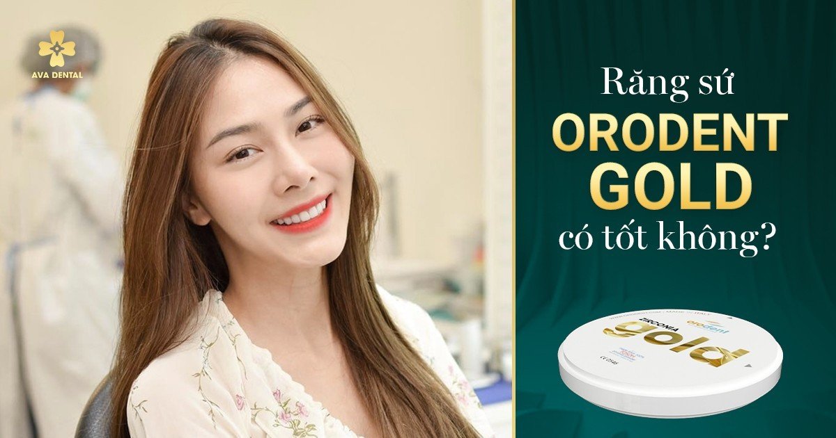 Răng Sứ Orodent Gold 14 ca8135393cd4e18ab8c5