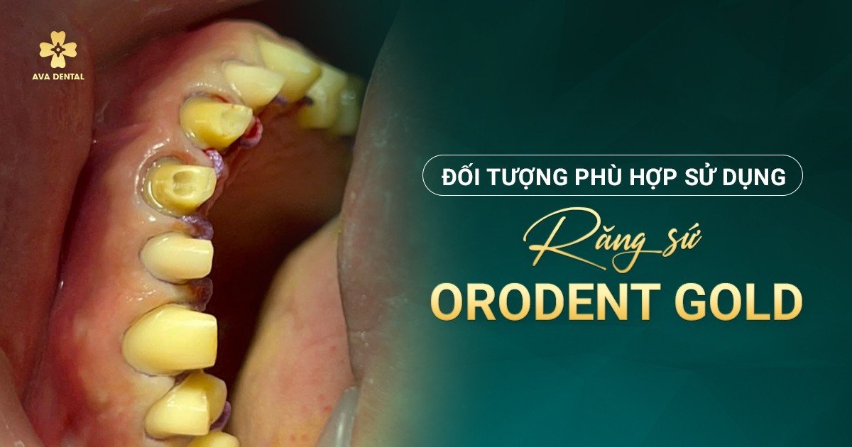 Răng Sứ Orodent Gold 13 e7a7cf12c6ff1ba142ee
