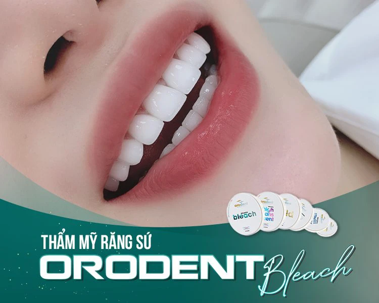 Răng sứ Orodent Bleach Innovation - Giải pháp hiệu quả cho một nụ cười hoàn hảo 8 orodent