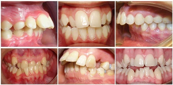cơ sở niềng răng uy tín tại TPHCM