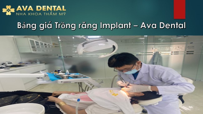 Bảng giá trồng răng Implant