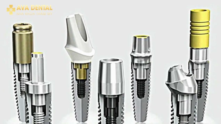 Mất Răng Lâu Năm Có Trồng Implant Được Không? 11 mất răng lâu năm có trồng implant được không