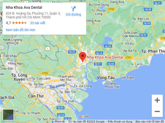 Địa chỉ trồng răng Implant tại TPHCM