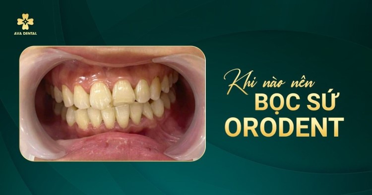 Khi nào nên Bọc răng sứ Orodent