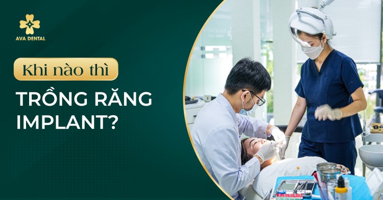 Khi nào thì Trồng Răng Implant