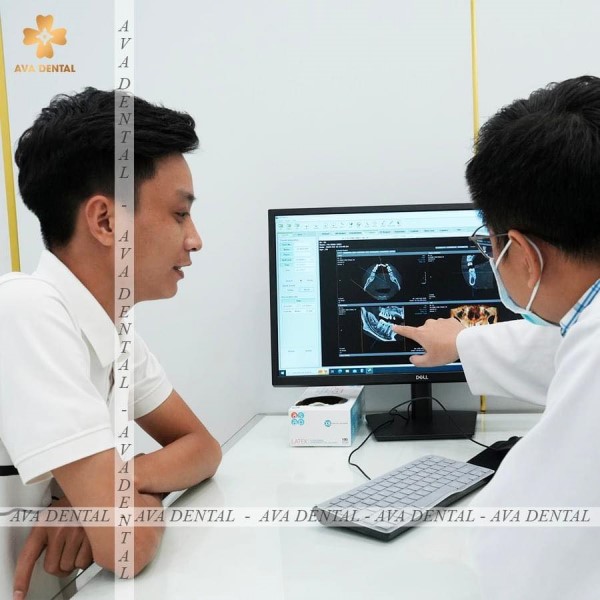 Trồng răng Implant có đau không 15 Một số lưu ý để giảm đau sau khi cấy ghép Implant