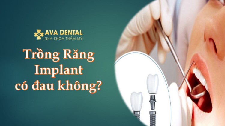 Trồng răng Implant có đau không 10 Trồng răng Implant có đau không