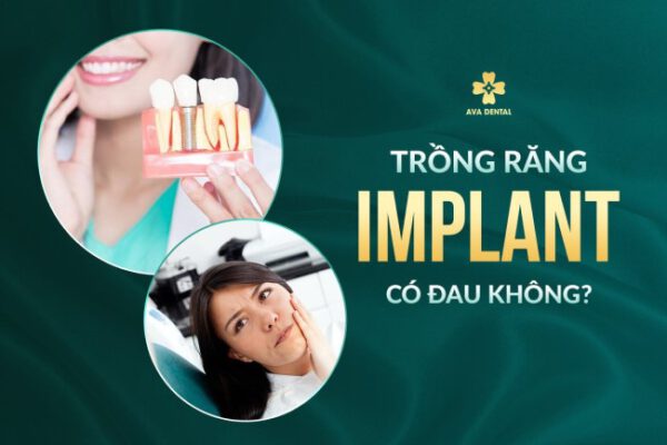 Trồng răng Implant có đau không