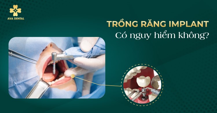 Trồng răng Implant có nguy hiểm không