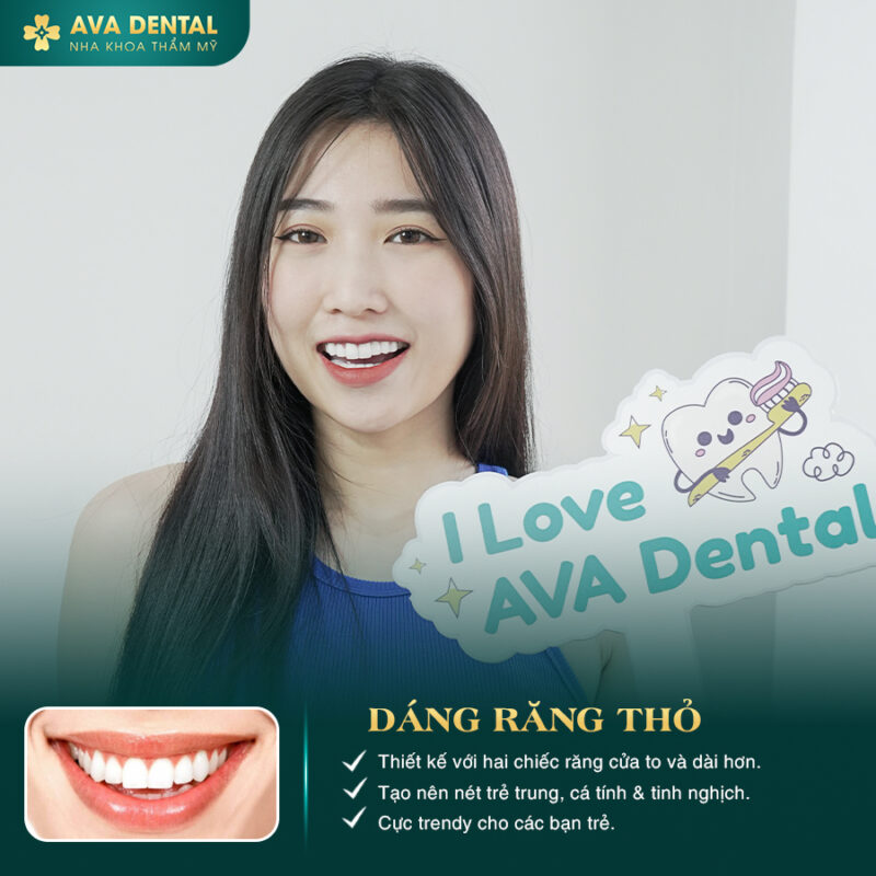 Các kiểu bọc răng sứ thẩm mỹ thịnh hành nhất hiện nay 4 369351234 674969997995674 2917456403920609009 n