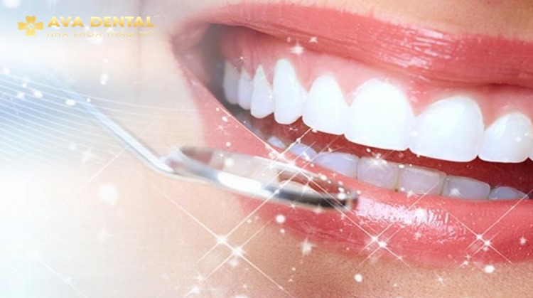 Độ tuổi bọc răng sứ là bao nhiêu? Trường hợp nào không nên bọc răng sứ 4 Độ tuổi bọc răng sứ là bao nhiêu