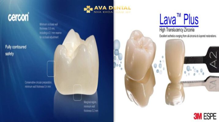 So Sánh Hai Dòng Răng Sứ CERCON HT Và LAVA 3M PLUS