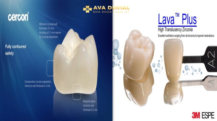 Sự khác biệt giữa hai dòng răng sứ CERCON HT Và LAVA 3M PLUS 5 So Sánh Hai Dòng Răng Sứ CERCON HT Và LAVA 3M PLUS