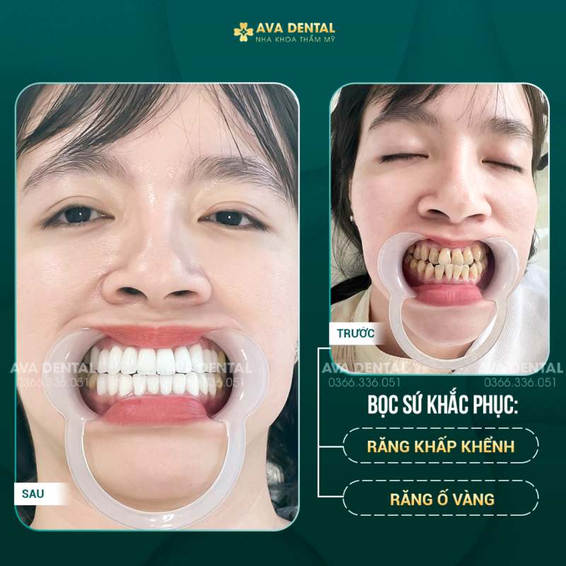 230819NA10