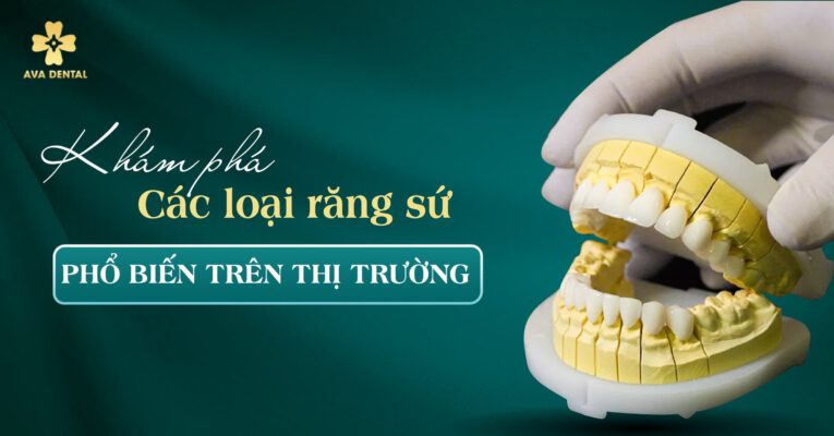 các loại răng sứ