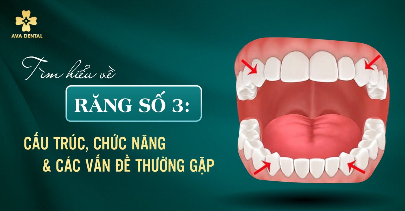 răng số 3