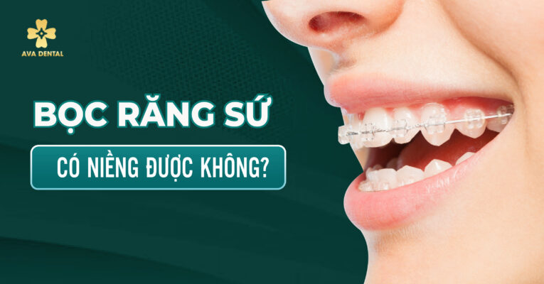 Tìm hiểu về việc bọc răng sứ có niềng được không?