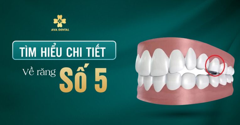 răng số 5