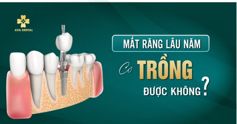 mất răng lâu năm có trồng được không?