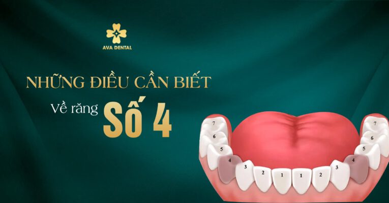 răng số 4