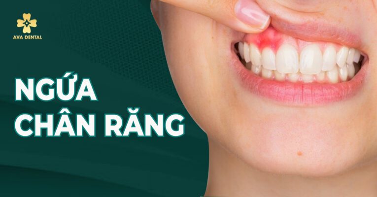 ngứa chân răng