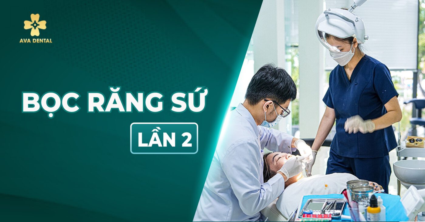 bọc răng sứ lần 2