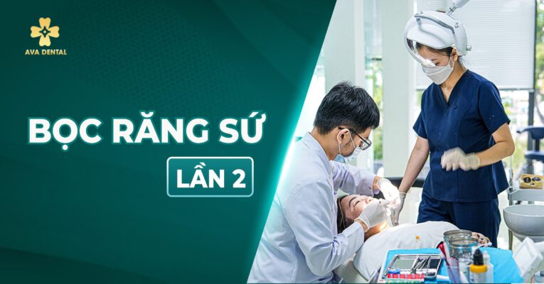 bọc răng sứ lần 2