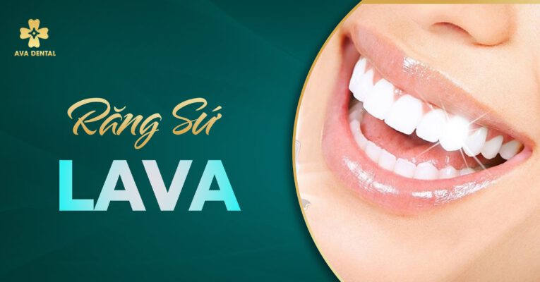 răng sứ Lava