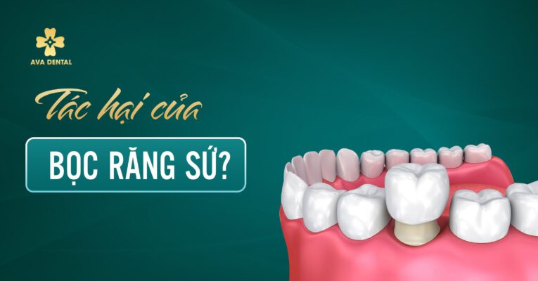tác hại của bọc răng sứ