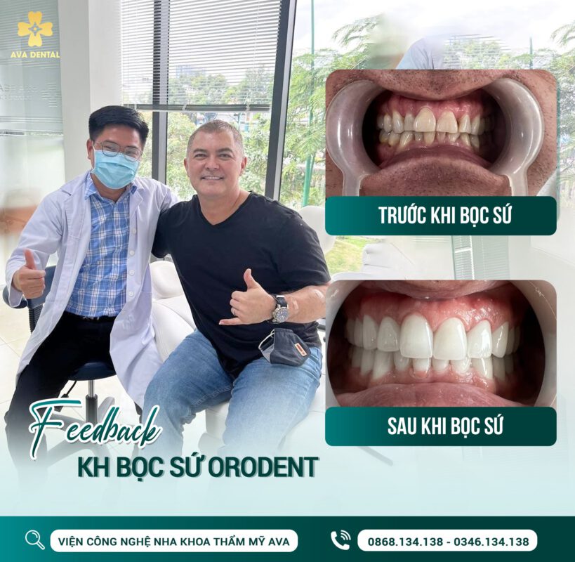 Tìm hiểu chi tiết: Bọc răng sứ bao lâu thì phải làm lại? 6 342033343 264136092633896 4617524232765703285 n