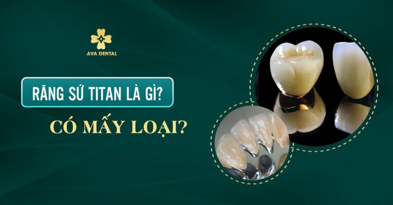 răng sứ Titan
