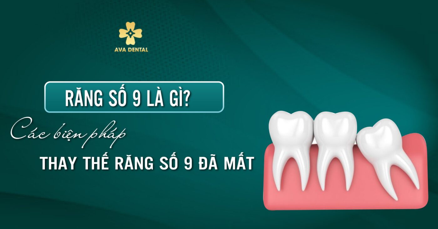 Răng số 9 là gì? Các biện pháp thay thế răng số 9 đã mất 3 răng số 9