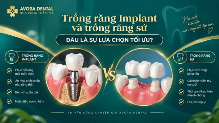 avora dental implant rang su 900px