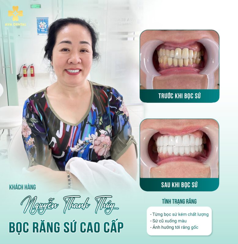 U xương chân răng là gì? Cách phòng tránh hiệu quả 5 340768980 758976255627980 1463251870857166561 n