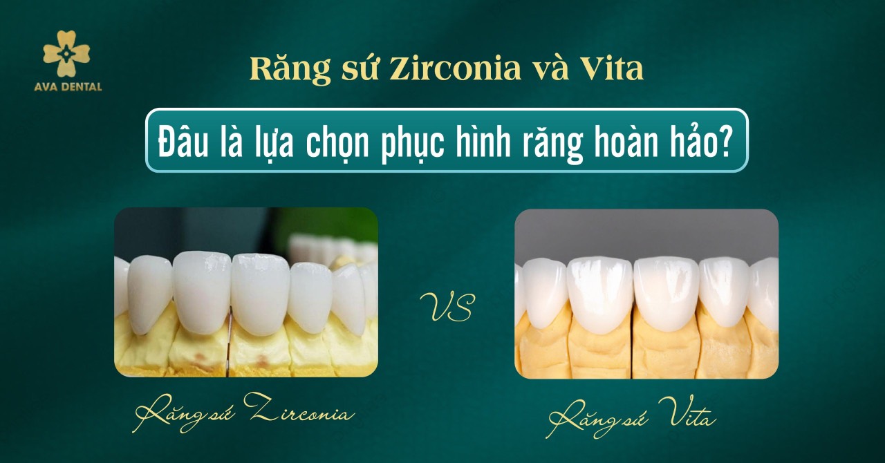 Răng sứ Zirconia và Vita: Đâu là lựa chọn phục hình răng hoàn hảo? 4 răng sứ Zirconia và Vita