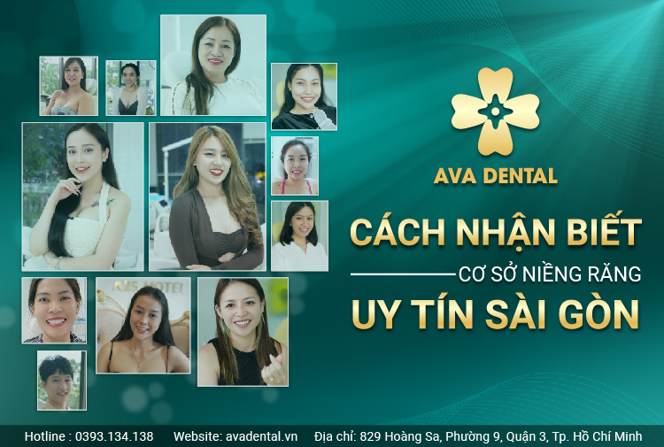 niềng răng uy tín tại Sài Gòn