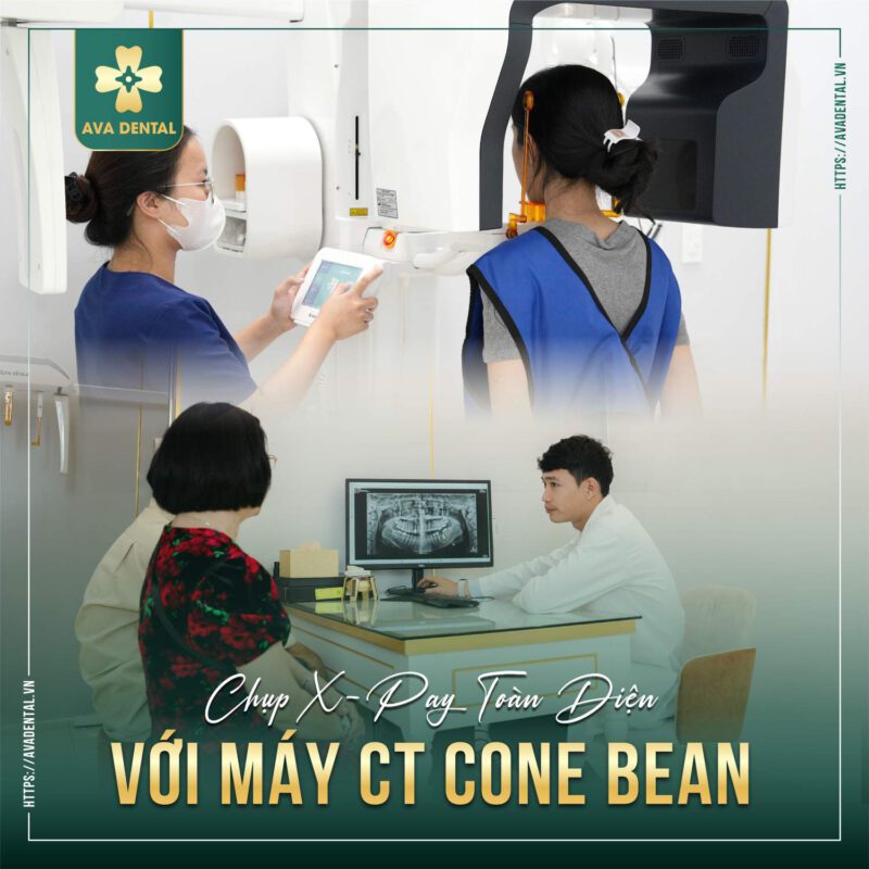 niềng răng trả góp