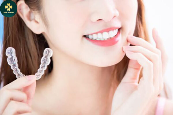 niềng răng trong suốt