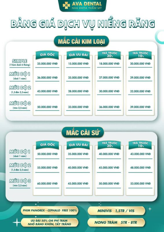 bảng giá niềng răng